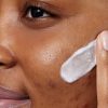 CeraVe Acne Foaming Cream Wash with Benzoyl Peroxide 10%
